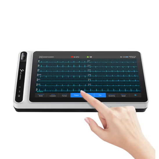 elettrocardiogrammo condivisione ecg invio telerefertazione pdf tablet ecg s120 pqrst